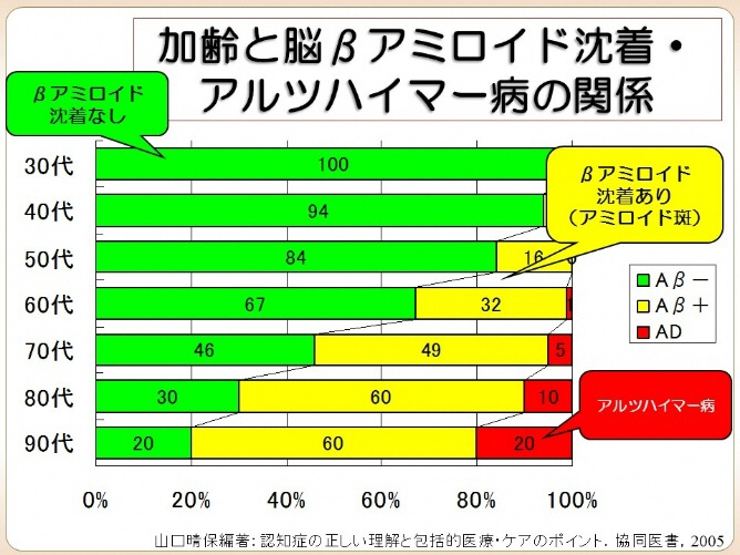 認知症の原因となる病気