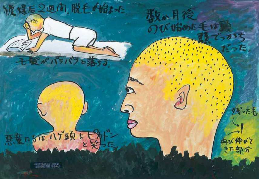 髪の毛