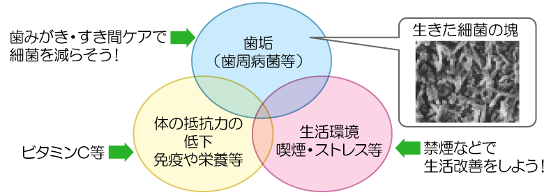 歯周病のリスク因子と対策の図