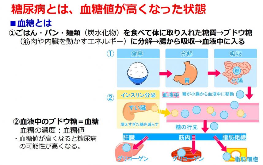 糖尿病に関連した失明の原因は何ですか?