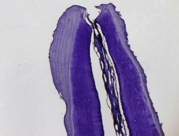 歯に形成された年輪
