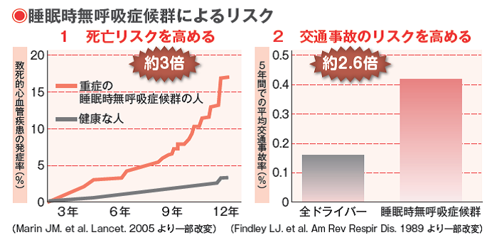 命に関わる、怖いいびきの話