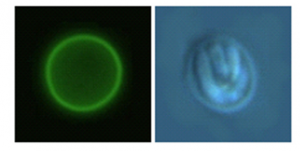 クリプトスポリジウムの顕微鏡画像
