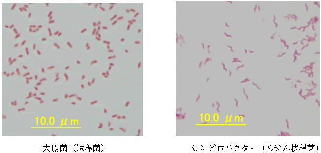 グラム 染色 方法