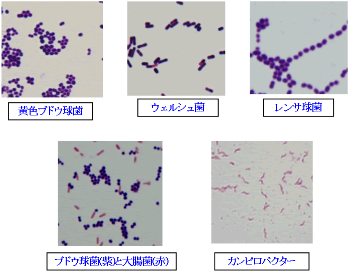 グラム 染色 方法