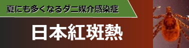 夏にも多くなるダニ媒介感染症　日本紅斑熱