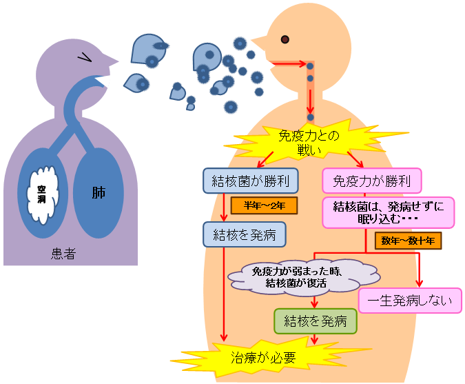 疥癬の再発を防ぐにはどうすればよいですか?