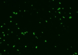 間接蛍光抗体法による寄生虫の確認