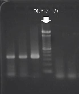 増幅した病原体特異遺伝子のゲル電気泳動像